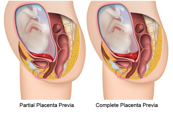 The important role of placenta in pregnancy and ways to keep it healthy