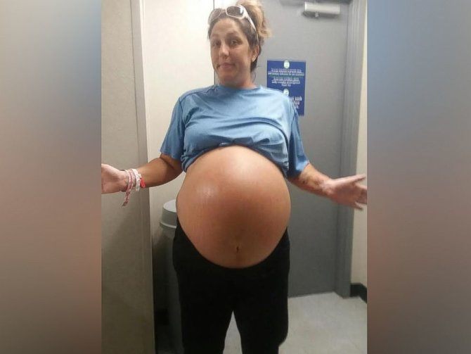 Florida mum gives birth to record-breaking 13-pound baby